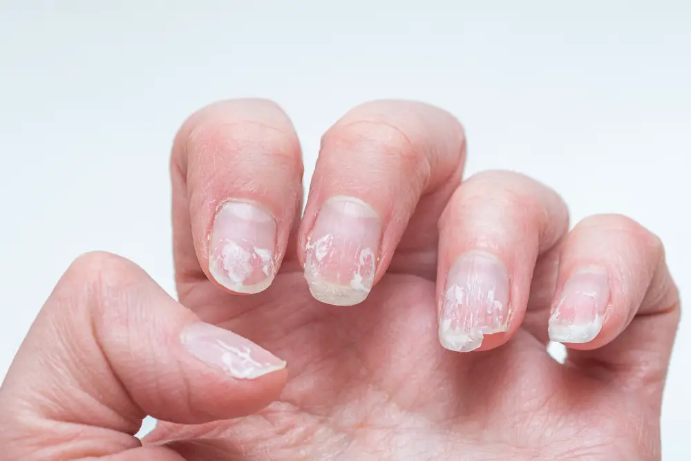 Does Nail Glue Damage Nails