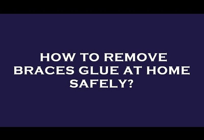How to Remove Braces Glue at Home